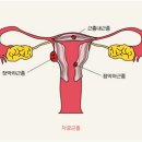 유앤이한의원 네이버블로그