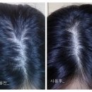 바크먼트 이미지