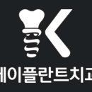 케이플란트치과의원 네이버블로그