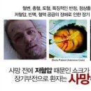 유니더스 에볼라관련주 대장주등극인가? -- 에볼라바이러스관련주 총정리 (3편) 이미지