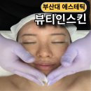 케어로 | 부산대 피부관리 뷰티인스킨 수분진정케어로 예민 피부 관리 후기