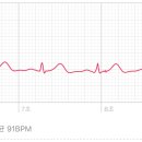 애플워치 심전도 관련 이미지