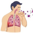 중동호흡기증후군(MERS) (Middle East Respiratory Syndrome) 이미지