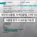 놀람주의) 킥보드 단속하다 10대 뇌출혈 사고 발생 이미지