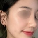 우아인성형외과의원 이미지