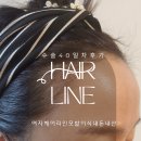 흥미헤어라인 | 여자헤어라인모발이식후기_수술40일차
