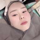 남양주 다산동피부과 고우리부스터 피부탄력시술 중 효과 좋았던 후기