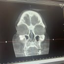 노즈랩의원 이미지