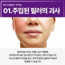 세진의원 | 세진성형외과 필러부작용 발생시, 팔자필러부작용치료