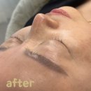 위드미 의정부평화로점 | 의정부 스킨플래닝 후기 각질 모공 한번에 관리하는법 제이수뷰티