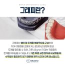 성원치과의원 네이버블로그