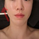 끌리메 | 광주 윤곽관리 전문 '끌리메' 작은얼굴관리 후기