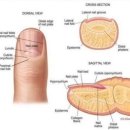 손톱주변에 일어난 살갗 함부로 뜯어버리면 안되는 이유: 조갑주위염(생인손)이란 이미지