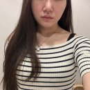 명동예쁨주의쁨의원 | [ 피부 | 명동 ] 명동역 예쁨주의쁨의원 스킨부스터 필로드 시술후기! ( 리쥬란 동일성분 )