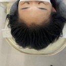 헤어스케치 M | 두피 타투, M자 헤어라인 원상복구 후기 [유주얼]