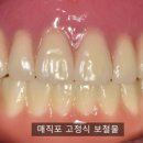 뿌리깊은 이정근치과의원 네이버블로그