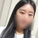 리아이성형외과의원 네이버블로그