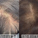 인토탈뷰티