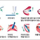 치카치카 이미지