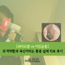 [외이도염/이진균증] 귀 먹먹함과 욱신거리는 통증 실제 치료 후기