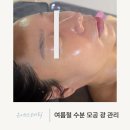 김나은피부샵 | 울산 옥동피부관리 푸석하고 지친 피부엔? 여름철 수분 모공 광 관리