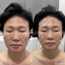 라미르스킨룸