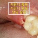 턱편한사랑니치과의원 이미지