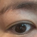 최진수안과의원 이미지