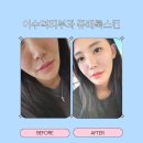 이수역 5번 출구 앞 | 이수역 피부과 쥬베룩스킨 후기