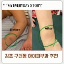 리멤버피부과의원 | 김포 구래동 리멤버 피부과 난치성 모반 클리닉 이소성 몽고반점 치료 전후 비교