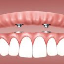 천안더맑은치과의원 이미지