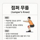 점퍼 무릎 (Jumper’s Knee) 이미지