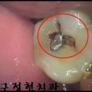 정현치과 이미지
