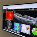 정안과의원 | 구리역 눈눈안과의원 안구건조 당뇨망막 황반변성 녹내장 등 중증 안과 질환, IPL레이저 진료 후기