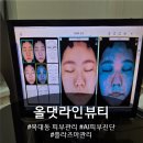 루카스올케어뷰티 | 청주 복대동 피부관리 올댓라인뷰티 AI 피부진단 살균플라즈마관리후기