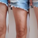 언조엇니