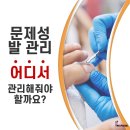 나도 손톱, 레푸스 개봉점