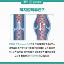 하지정맥류 약으로 널리 알려진 센시아, 고투콜라-어떤 효능을 기대할 수 있을까? 이미지