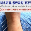 척추지압교정원 이미지