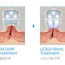 미라메디