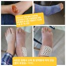 DH메디컬 | [공지] 도화신경외과 실사례 이용후기 (요통, 발목 접지름 치료중)
