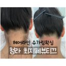 뷰티끄라인 | 청라 왁싱샵 최지혜뷰티끄 여름 준비 첫 헤어라인 왁싱 후기