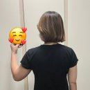 (주)팻라인 | [등살빼기 후기] 부분다이어트 뒷날개·등살 이오팻주사 2회차, 진짜 효과 체감 시작!