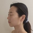엔스킨 - 하남시 미사강변동로84번길 29 | 1회만으로 바로 효과 본 미사윤곽관리 끝판왕 엔스킨 내돈내산 무턱 없앤 후기