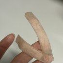 해탈, 그 이후의 | 세미아웃라인 비절개 자연유착+눈매교정+눈두덩이 지방제거 일주일차 내돈내산 리얼후기