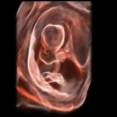 엔도소노 이미지