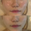 충주 피부관리 | 유어에스테틱 웨딩 관리 후기: 바디슬램젯 & 수분 진정 갈바닉으로 라인 정리 끝!