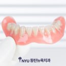 동탄미소치과의원 | 동탄역치과, 틀니와 임플란트 고민된다면? 내게 맞는 편안한 선택 기준