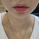 신사-110 | 강남 신사 입술필러 입꼬리필러 입꼬리보톡스 내돈내산 후기