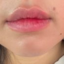 섬세한사랑니치과의원 이미지